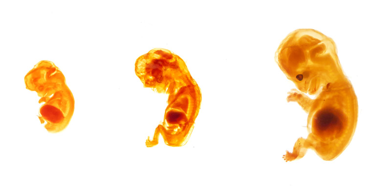 Primo trimestre di gravidanza - Lo sviluppo del feto