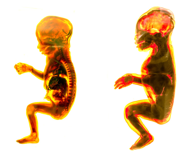 Terzo trimestre di gravidanza - Lo sviluppo del feto