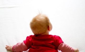 Crosta lattea neonato, tutto quello che devi sapere crosta lattea