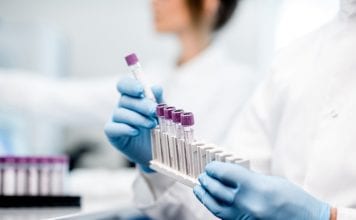 Test di Coombs in gravidanza: cos’è e perchè farlo test coombs in gravidanza