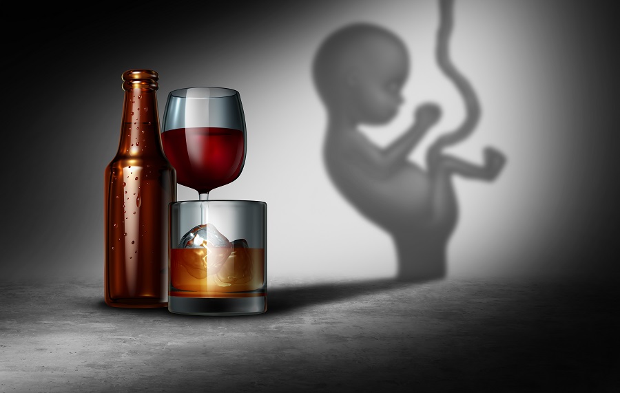 sindrome feto alcolica