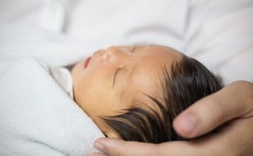 Ittero neonatale, cosa sapere? Cos’è, quanto dura, come curarlo Cosa sapere sull'ittero neonatale Cos'è, quanto dura, come curarlo