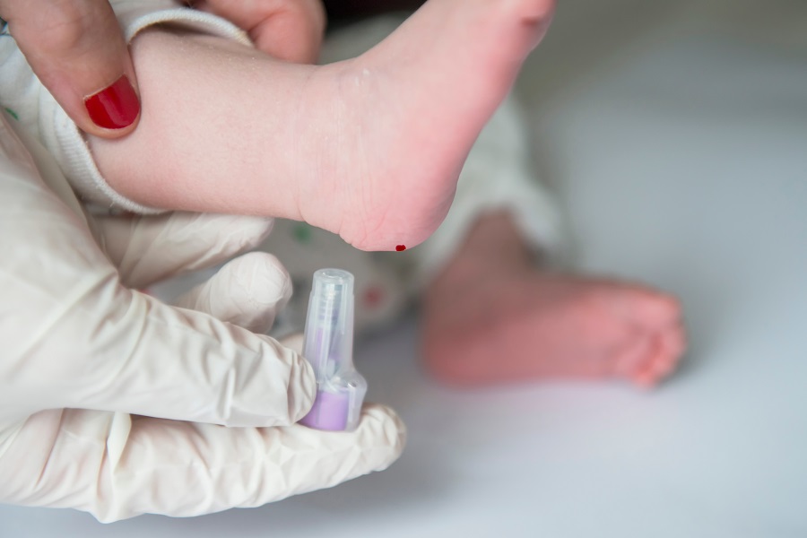 Screening neonatale di cosa si tratta e a cosa serve - test malattie genetiche