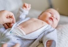 Granuloma ombelicale del neonato, cos’è e come curarlo Granuloma ombelicale del neonato, cos'è e come curarlo