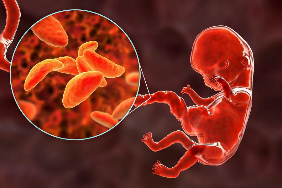 Tutto quello che c'è da sapere sulla toxoplasmosi in gravidanza2