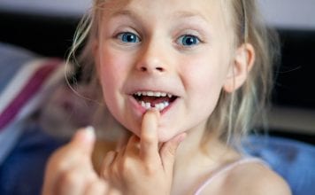 Denti da latte, tutto quello che c’è da sapere Denti da latte, tutto quello che c'è da sapere