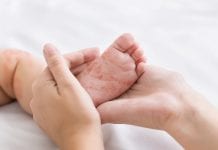 Ittiosi neonatale: cause, sintomi e cure Ittiosi neonatale cause, sintomi e cure