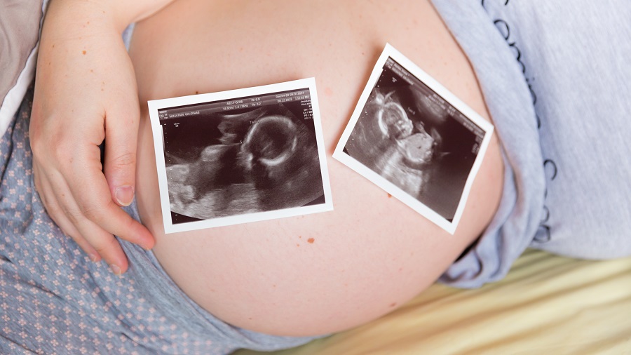 I sintomi di una gravidanza gemellare da riconoscere2