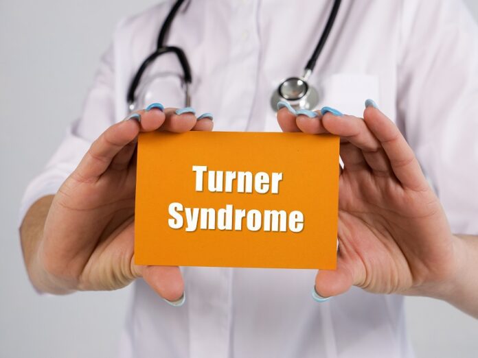 Sindrome di Turner, di cosa si tratta e quali sono i sintomi?