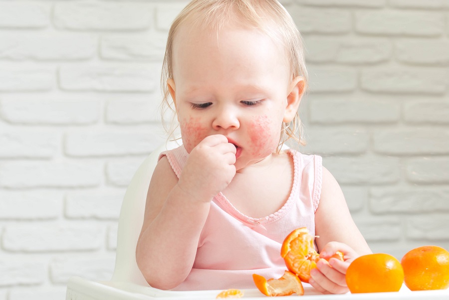 Svezzamento bambini cosa sapere sugli alimenti allergizzanti