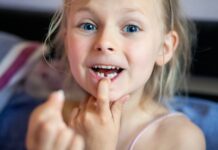Dente da latte rotto o scheggiato: cosa fare e quando preoccuparsi Dente da latte rotto: cosa fare?