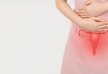 Concepimento, cosa sapere sulla cisti dermoide dell’ovaio Concepimento, cosa sapere sulla cisti dermoide dell'ovaio